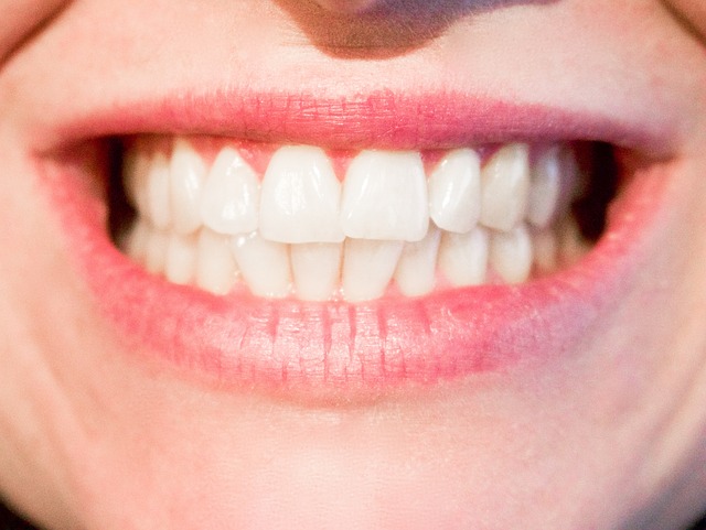 Schöne Zähne sind absolut individuell